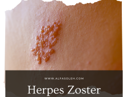 Kenali jenis Virus Herpes yang menyerang tubuh kita.