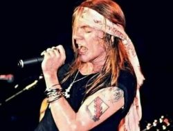 AXL Rose vocalist Guns N Roses yang mengalami perubahan dulu dan saat ini .