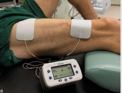 Fisioterapi seperti apa yang paling efektif untuk penderita Injury Brachial Plexus