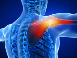 Terapi musik menawarkan banyak manfaat bagi individu dalam rehabilitasi untuk penderita Injury Brachial Plexus (Cedera Saraf Lengan)